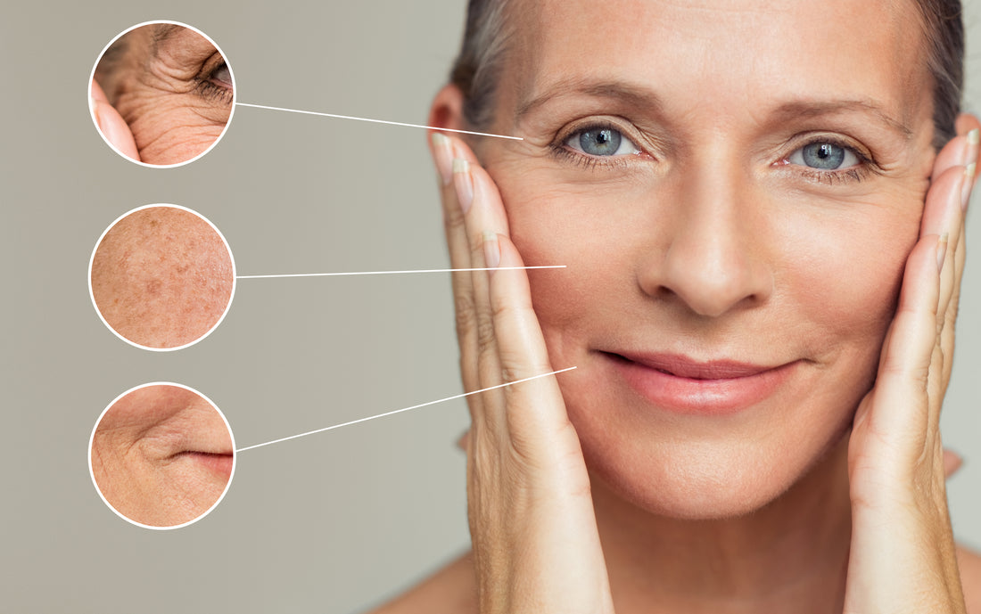 Ketosis as an "Anti-Aging Potion"